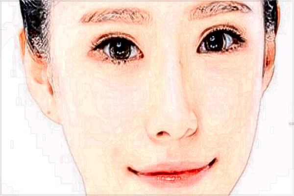 玻尿酸丰面颊多少钱?玻尿酸丰面颊需要几支?