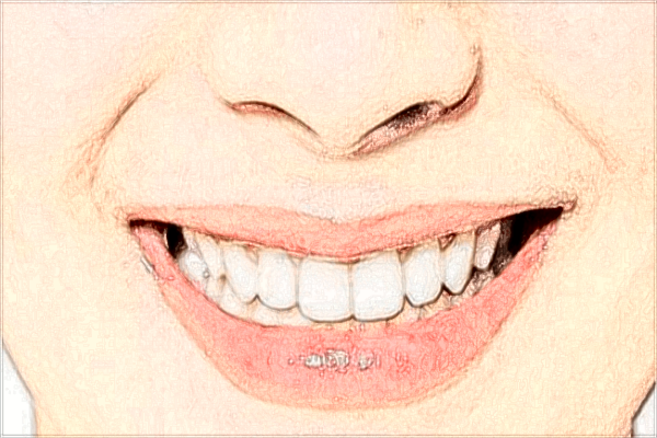 北京大学第三医院牙齿正畸价格?牙齿矫正有几种方式