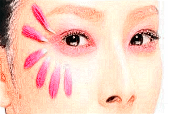 北京二院去法令纹怎么样?2024去法令纹价格