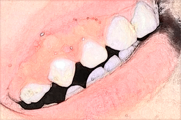 合肥105医院牙科比较好的医生收费价格2024
