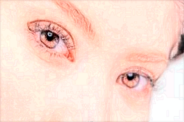 2024北京丽都去眼角细纹价格表_去眼角细纹好的方法