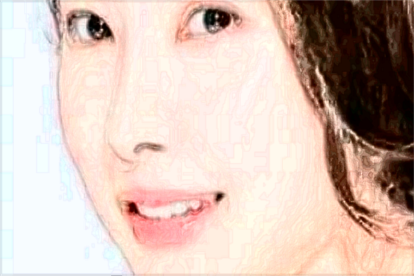 玻尿酸丰面颊能维持多久?玻尿酸丰面颊是*的吗?