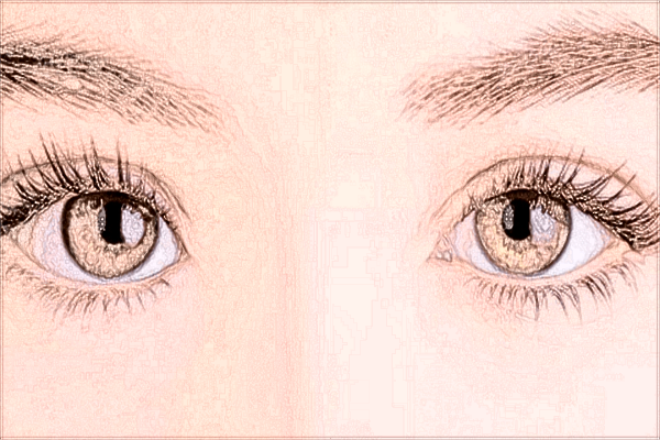 2024北京煤医割双眼皮收费价格?割双眼皮有哪些风险