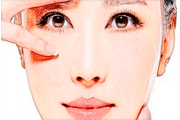 膨体隆鼻热敷会越来越严重吗?膨体隆鼻热敷可以敷鼻子吗?