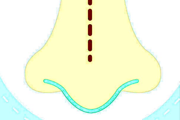 北京美莱怎么样?一般价格多少钱