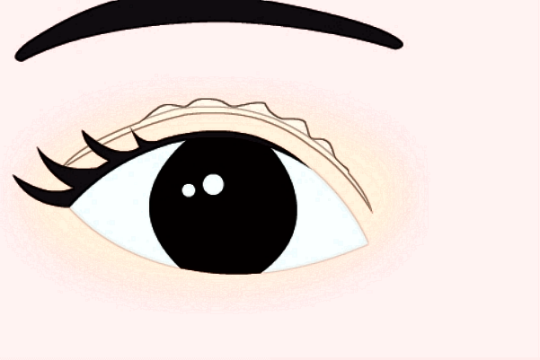 2024做卧蚕收费价格多少_西安二院做卧蚕怎么样