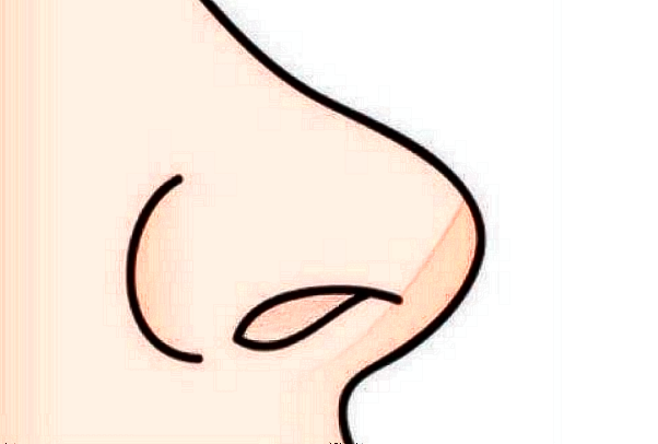 成都百龄做肋骨鼻怎么样?肋骨鼻手术费用价格2024