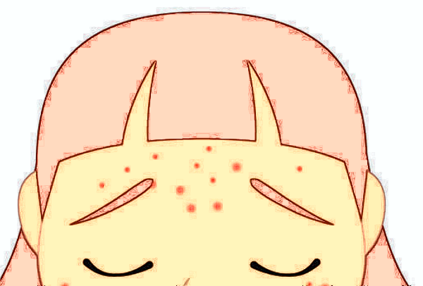 嘉兴二院自体脂肪填充好吗?2024自体脂肪填充手术价格