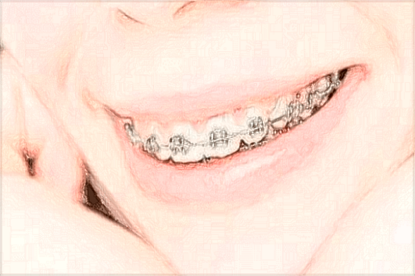 2024四川省人民医院口腔科好不好_医生技术哪位好