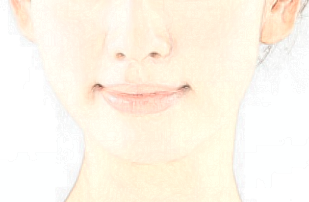 四川省人民医院激光祛斑价目表(价格表)怎么样