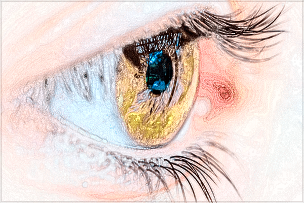 2024成都格莱丽做双眼皮价格?医生双眼皮案例