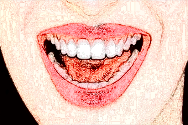 2024淮北市人民医院口腔科专家名单介绍【种植牙案例】