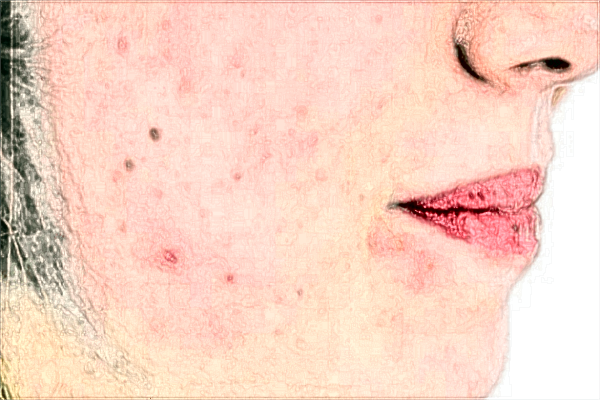 漳州175医院整形科怎么样?2024整形科医生收费价格