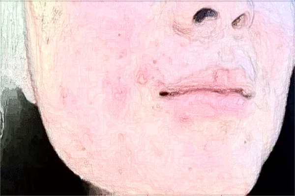 漳州175医院整形科怎么样?2024整形科医生收费价格