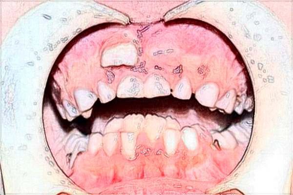 2024赣南医学院第一附属医院口腔科医生哪些好?收费价格