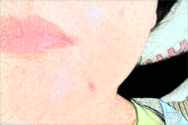 赣南医学院第一附属医院光子嫩肤多少钱2024?光子嫩肤好吗