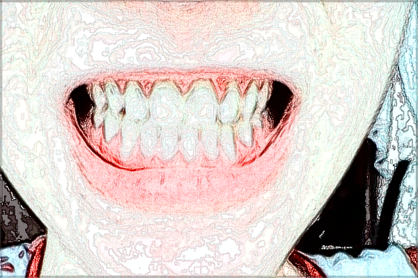 2024上海曙光医院种植牙怎么样_做的好不好