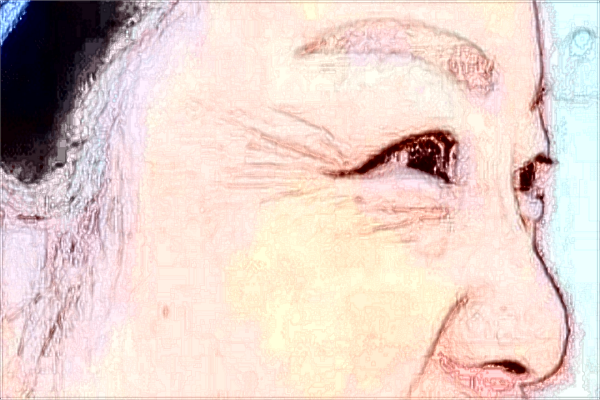 漳州175医院祛斑好不好?2024漳州175医院激光祛斑价格