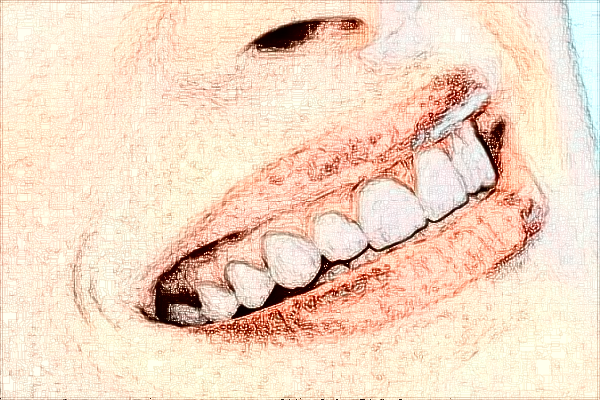 2024六安市人民医院口腔科怎么样_价格贵不贵