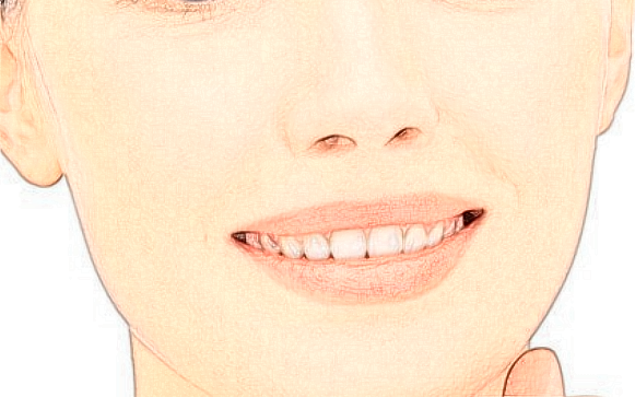 四川华西医院哪位医生做的好【案例】