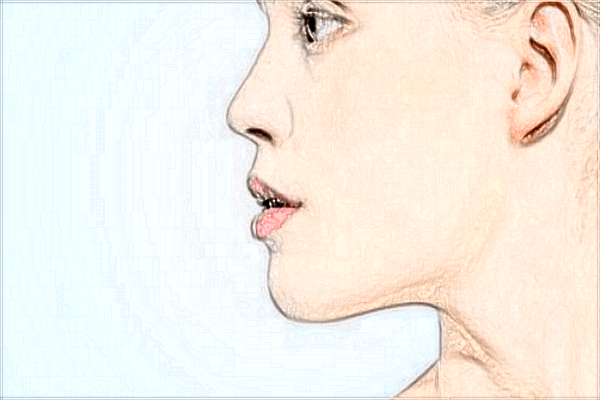 河科大二附院疤痕修复怎么样?2024疤痕修复新价格公布