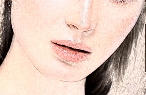 北京大学第一医院热拉提做的好吗【热拉提案例】