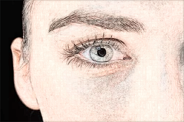 四川华西医院祛疤怎么样_案例分享