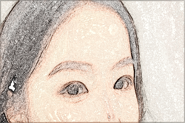 四川华西医院去痣价目表(价格表)怎么样