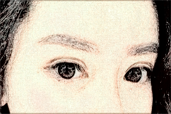 2024宁波市第一医院激光祛斑做的好吗_案例+价格