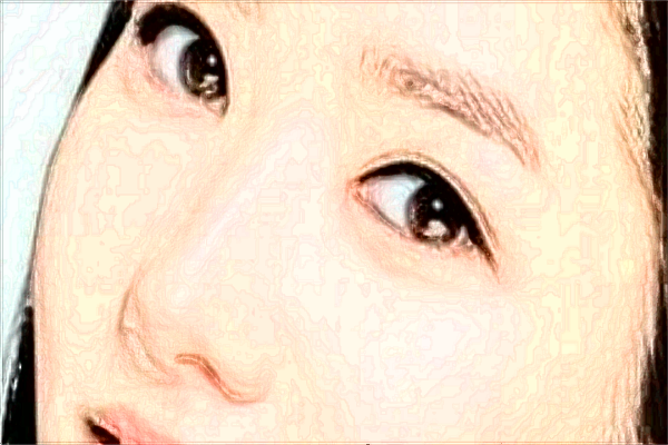 北京大学人民医院激光祛斑怎么样_激光祛斑的危害与效果