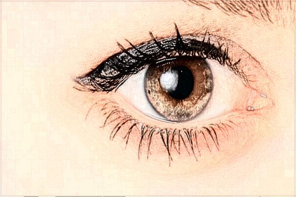 2024泰安市中医二院眼角提升怎么样?眼角提升价格公布