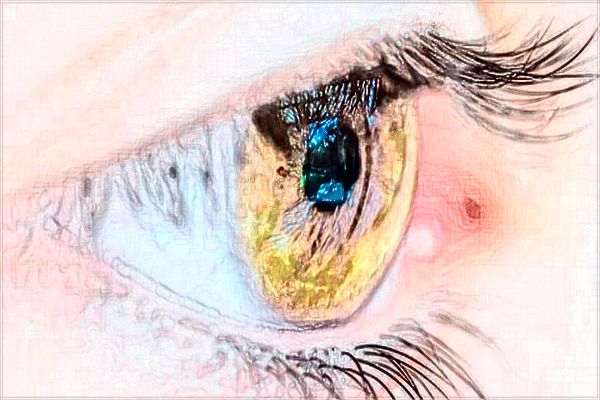 河科大二附院割双眼皮怎么样?割双眼皮新整形价格2024