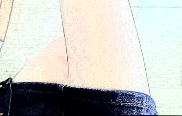 河科大二附院腿部脱毛好不好?2024腿部脱毛整形价格揭秘