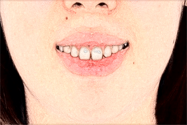 福建医科大学附属第二医院好不好?福建医科大学附属第二医院口腔科在哪里