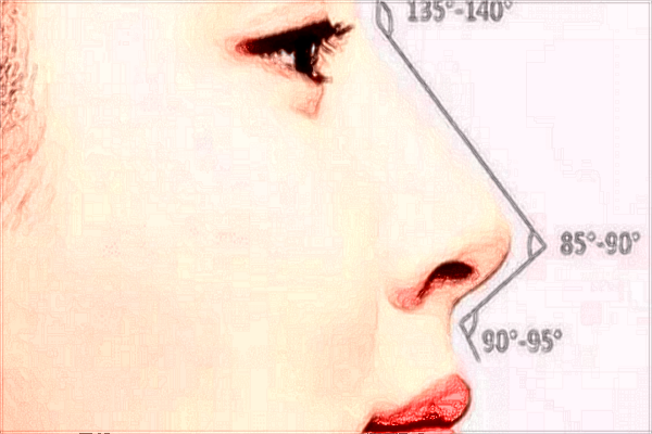 2024泰安市中医二院做隆鼻价格_隆鼻可以只垫山根吗