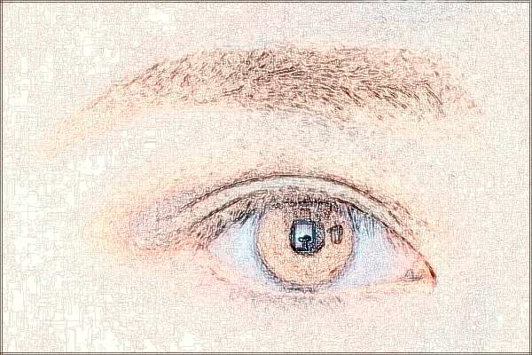 2024上海同济医院祛疤案例_做的怎么样