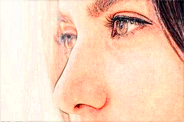 成都华西医院祛斑价目表_祛斑后的注意事项有哪些