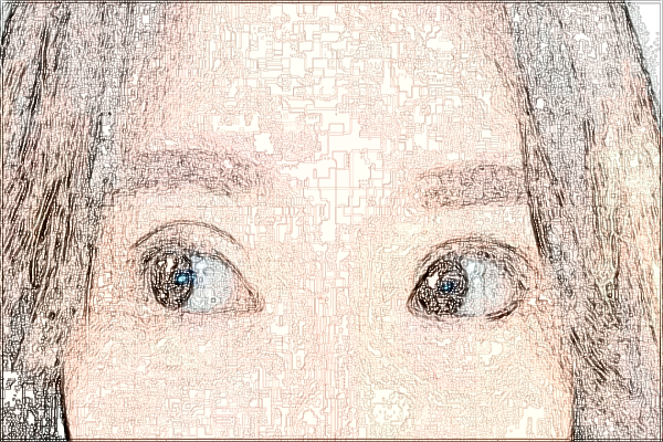 六安市人民医院光子嫩肤怎么样【光子嫩肤案例】