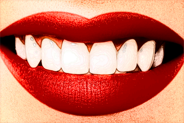 北大口腔医院植牙医生名单_附植牙案例