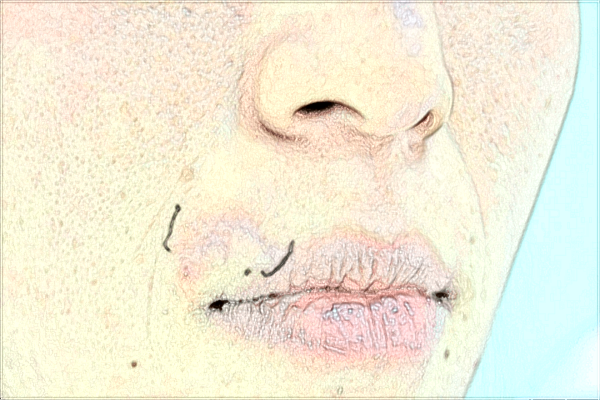 南昌大学第二附属医院激光美容科好吗?激光祛斑怎么样