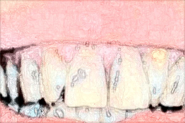 福建省立医院牙科怎么样?2024福建省立医院牙齿矫正多少钱