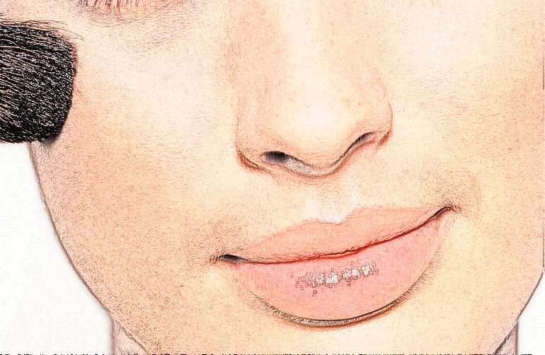 河北医科大学第一医院光子嫩肤价格多少_做的怎么样