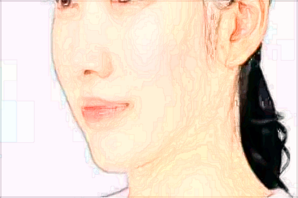 成都华西医院拉皮怎么样_哪些医生做的比较好