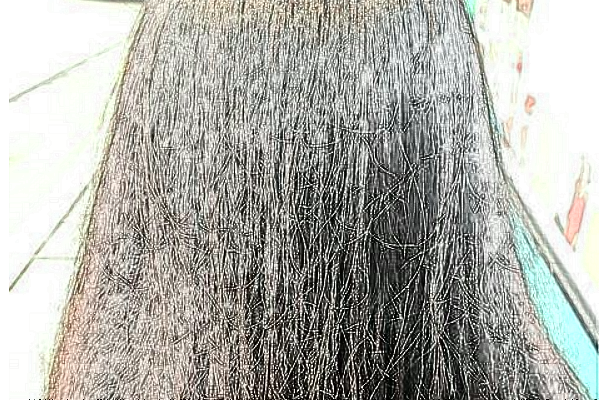 温州医学院附属第一医院种植头发做的好吗_哪位医生做的好