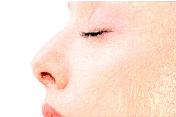 四川华西医院激光美容价目表(价格表)怎么样