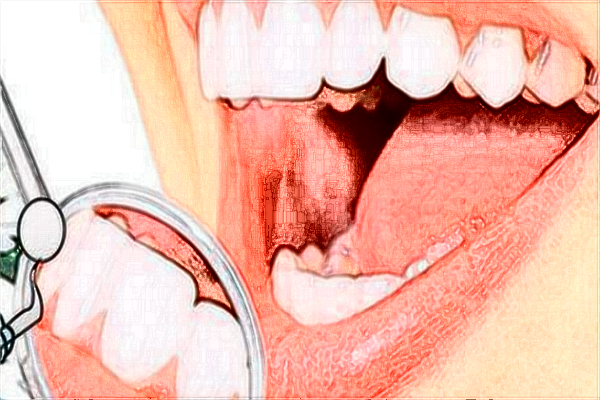 2024九江学院附属医院矫正牙齿的费用?矫正牙齿的危害