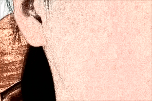 2024南昌大学第二附属医院祛斑多少钱?祛斑后多久恢复正常