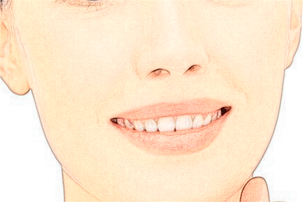 2024温州医学院附属第一医院激光脱毛价格多少_案例分享