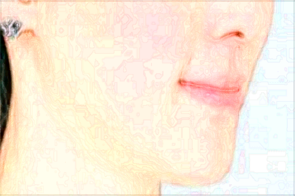 2024上海东方医院去痣怎么样