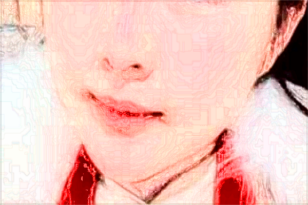 2024上海东方医院去痣怎么样